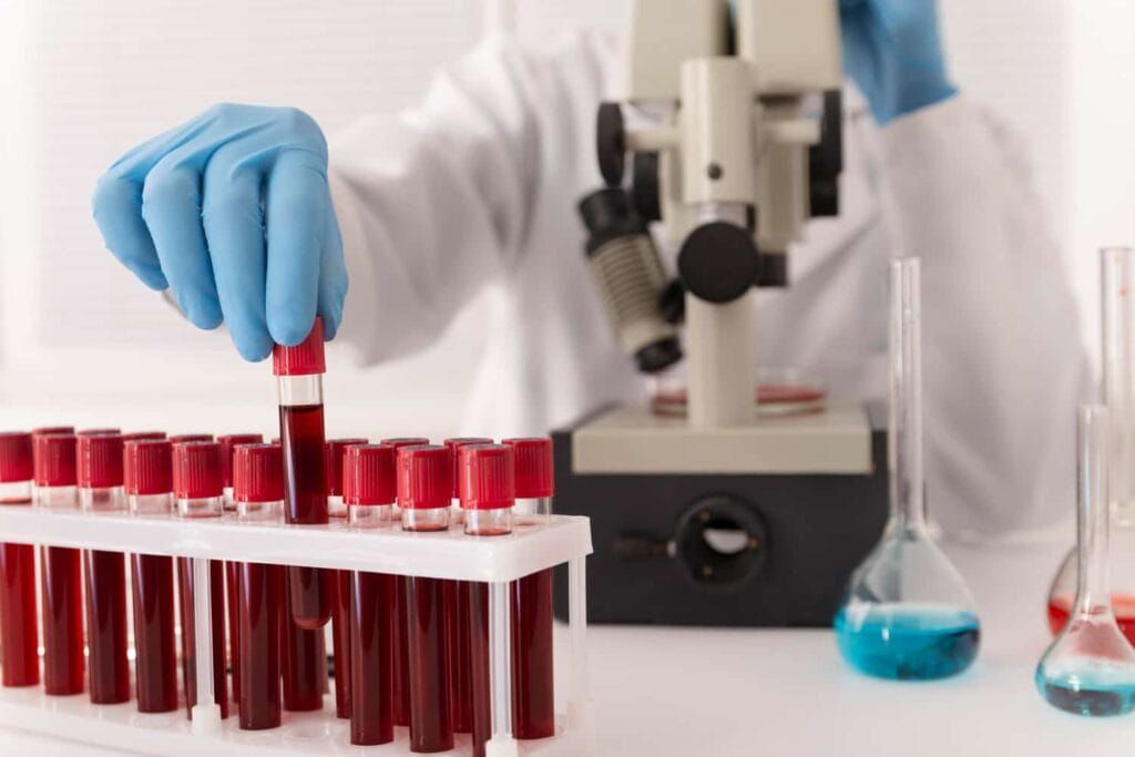 Photo of blood test