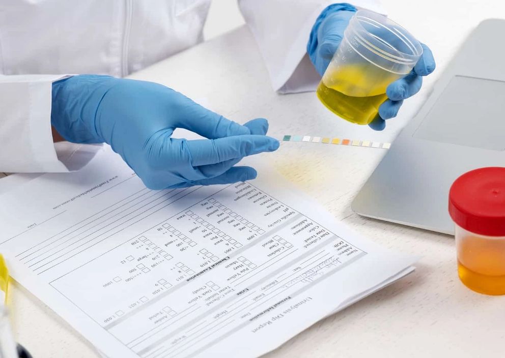 A medical professional in blue gloves holds a urine sample cup over a test strip and lab documents.