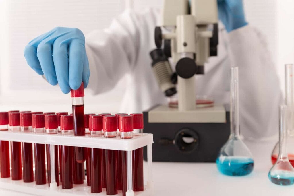 Photo of blood test