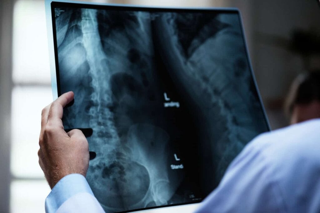 X-ray photo in the doctor's hand